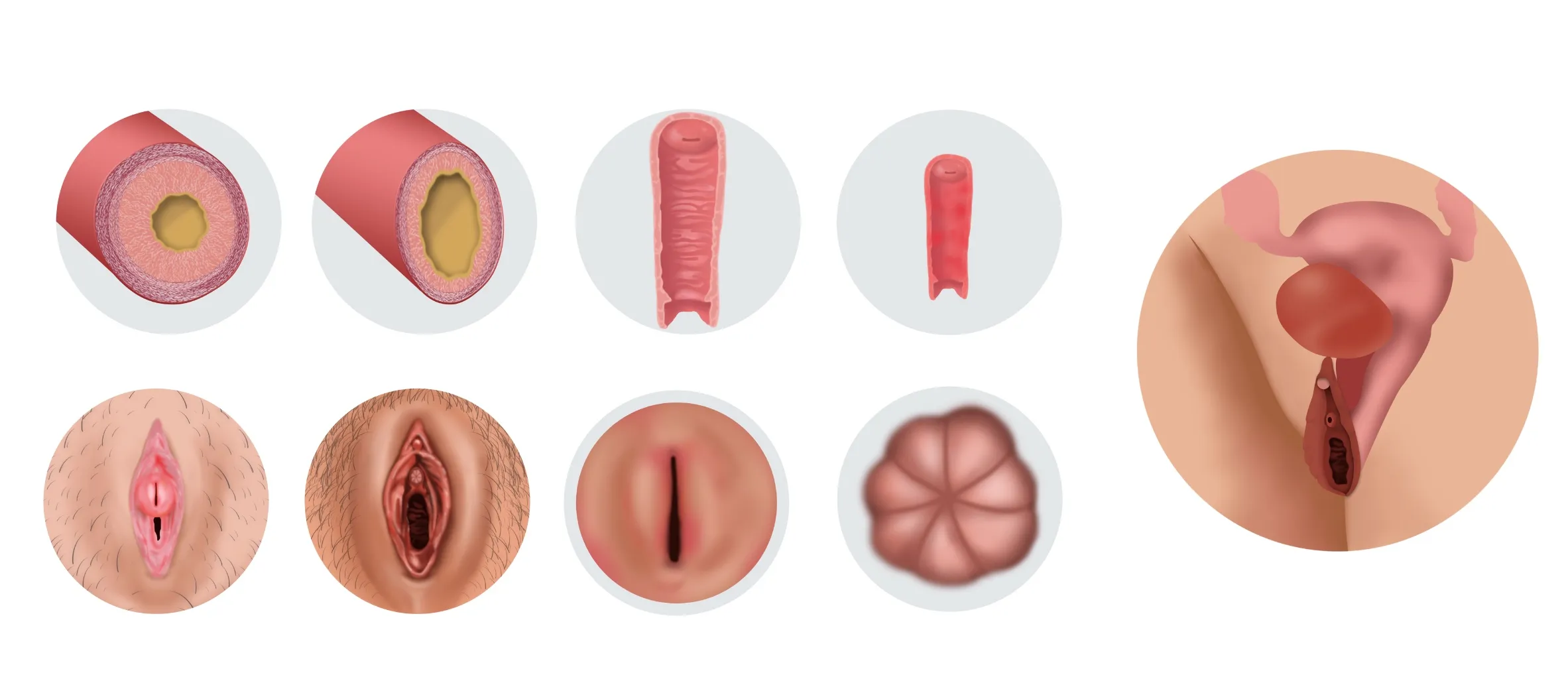 A sheet of medical illustrations: paired cross-sections of vessel and canal walls, circular vulvar views, and a side view of the reproductive organs